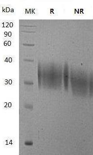 Mouse Vsir/Dies1/PD-1H/VISTA (His tag) recombinant protein