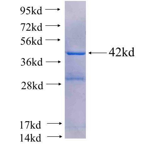 Recombinant human HBE1(Full length) SDS-PAGE