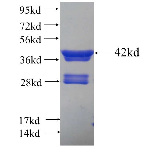 Recombinant human ID1 SDS-PAGE