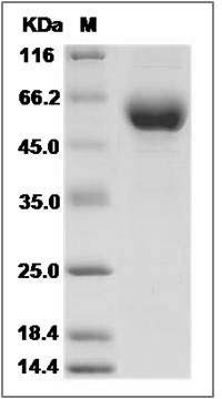 Human EDEM2 / C20orf31 Protein (His Tag) SDS-PAGE
