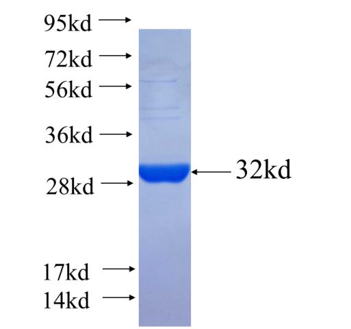 Recombinant human SCD5 SDS-PAGE