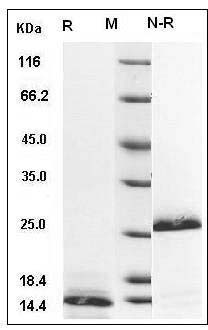 Human / Rhesus / Canine TGF-beta 1 / TGFB1 Protein SDS-PAGE