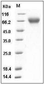 Mouse SerpinF2 Protein (His Tag) SDS-PAGE