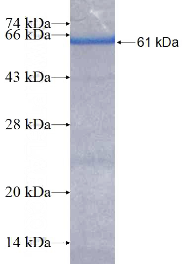 Recombinant Human DLAT SDS-PAGE