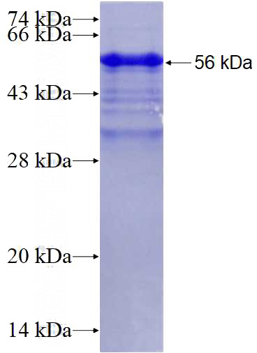 Recombinant Human ZC3H14 SDS-PAGE