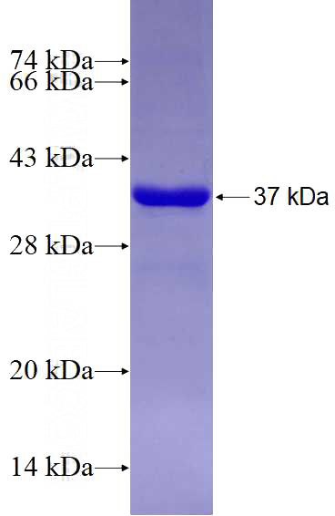 Recombinant Human AHR SDS-PAGE