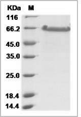 Ebola virus EBOV (Sudan ebolavirus, strain Gulu) Nucleoprotein / NP (aa361-aa738) Protein (His Tag)
