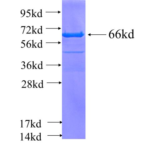Recombinant human ATP6V0D1(Full length) SDS-PAGE