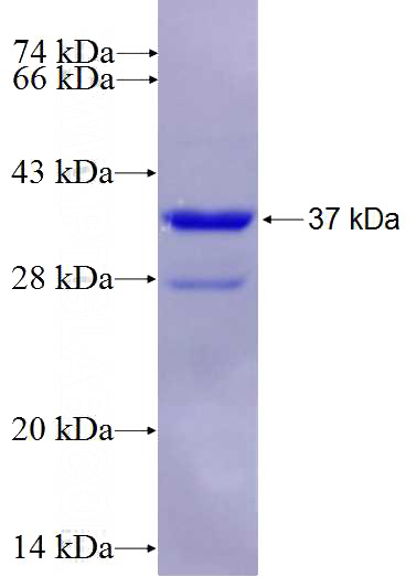 Recombinant Human WNT1 SDS-PAGE