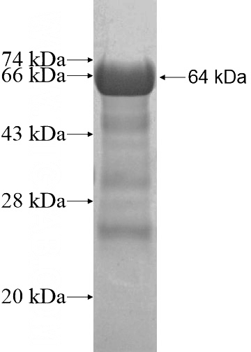 Recombinant Human DLG3 SDS-PAGE