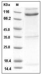 Mouse Nogo Receptor / NOGOR / RTN4R Protein (His & Fc Tag) SDS-PAGE