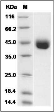 Human IZUMO1 Protein (His Tag) SDS-PAGE