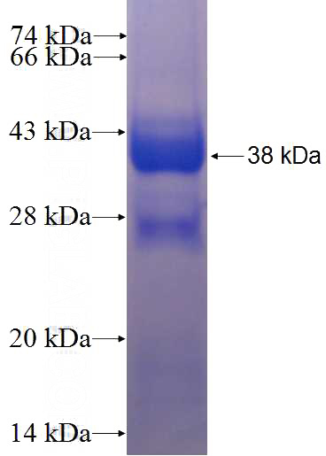 Recombinant Human IFRD2 SDS-PAGE