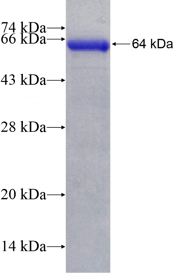 Recombinant Human HORMAD1 SDS-PAGE