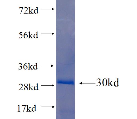 Recombinant human TRIM48 SDS-PAGE