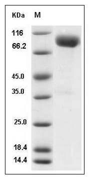 Mouse IL-1R8 / IL1RAPL1 Protein (Fc Tag) SDS-PAGE