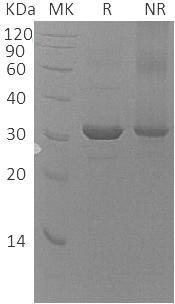 Human UBE2Z/HOYS7 (His tag) recombinant protein