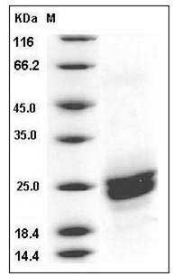 Mouse PLA2G12B / PLA2G13 Protein (His Tag) SDS-PAGE