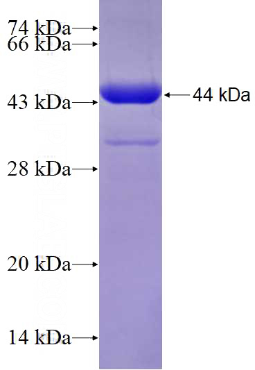 Recombinant Human EFHC1 SDS-PAGE