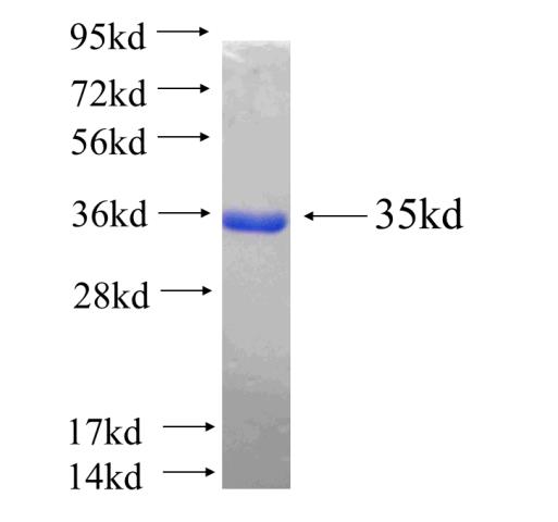 Human KDR Recombinant protein (His tag)