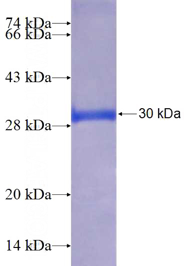 Recombinant Human C12orf44 SDS-PAGE