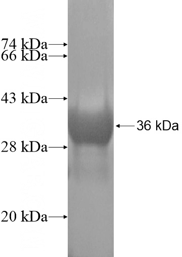 Recombinant Human FAM107B SDS-PAGE