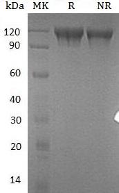 Human SEMA4D/C9orf164/CD100/SEMAJ (His tag) recombinant protein