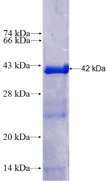 Recombinant Human Recoverin SDS-PAGE
