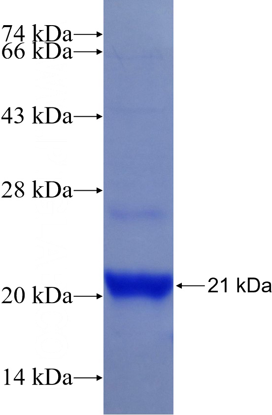 Recombinant Human NME2 SDS-PAGE