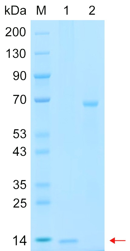 Recombinant SMD1 protein (His tag) SDS-PAGE
