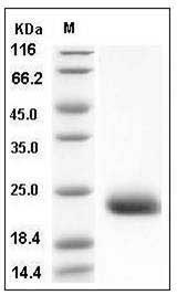 Mouse CLEC4N / CLEC6A / Dectin-2 Protein (His Tag) SDS-PAGE
