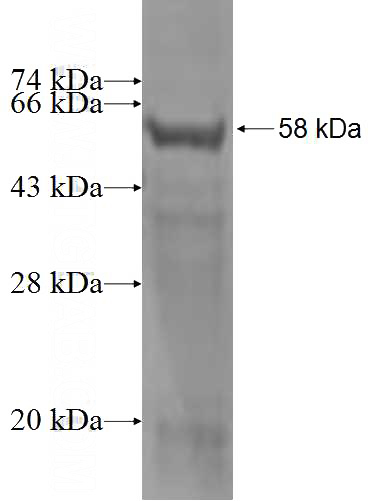 Recombinant Human TPTE SDS-PAGE