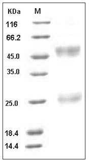 Influenza A H5N1 (A/turkey/Turkey/1/2005) Hemagglutinin / HA Protein (His Tag) SDS-PAGE