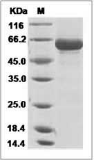 Influenza A H6N2 (A/duck/Shantou/83/2000) Hemagglutinin / HA Protein (His Tag)
