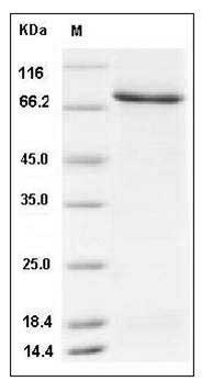 Human PFK2 / PFKFB3 Protein (His & GST Tag) SDS-PAGE