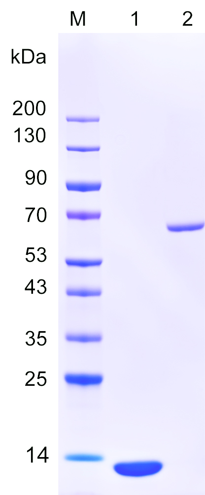 Recombinant APOL2 protein (His tag) SDS-PAGE