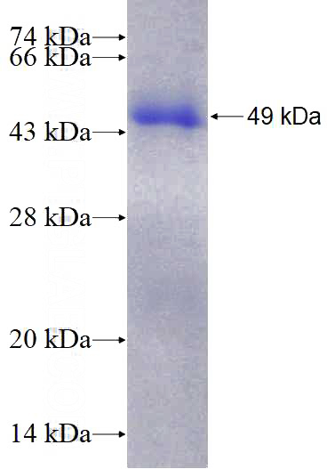 Recombinant Human SPAG4L SDS-PAGE