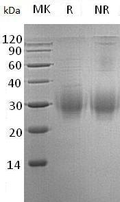 Human BTLA (His tag) recombinant protein