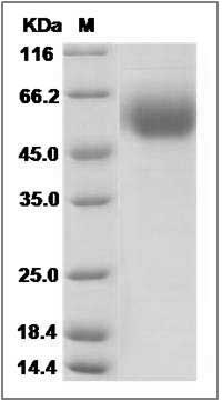Mouse IL1RL1 / ST2 Protein (His Tag) SDS-PAGE