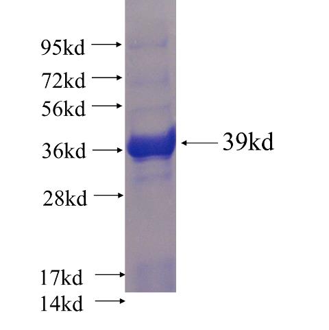 Recombinant human NDST2 SDS-PAGE
