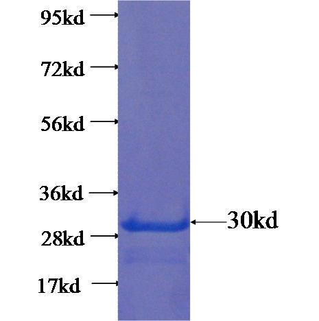 Recombinant human C6orf221 SDS-PAGE