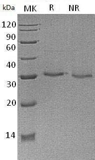 Human VSIG8/C1orf204 (His tag) recombinant protein