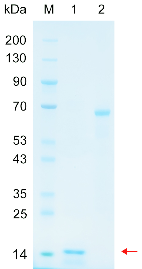 Recombinant SMBP2 protein (His tag) SDS-PAGE