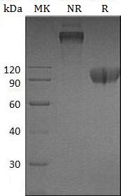 Human TNFRSF10C/DCR1/LIT (Fc & His tag) recombinant protein