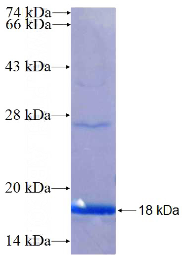 Recombinant Human CATSPER2 SDS-PAGE