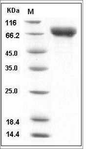 Influenza A H5N1 (A/Vietnam/1194/2004) Hemagglutinin / HA Protein (His Tag) SDS-PAGE