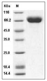 Influenza A H1N3 (A/duck/NZL/160/1976) Hemagglutinin / HA Protein (His Tag)