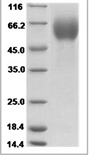 Cynomolgus IL13RA1/IL-13RA1 Protein 15532