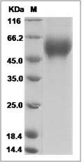 Influenza A H1N1 (A/California/06/2009) Hemagglutinin / HA1 Protein (His Tag)