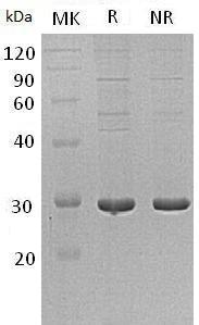 Human PDIA5 (His tag) recombinant protein